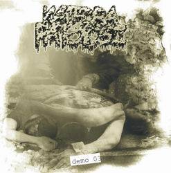 Katedra Patologii : Demo '03